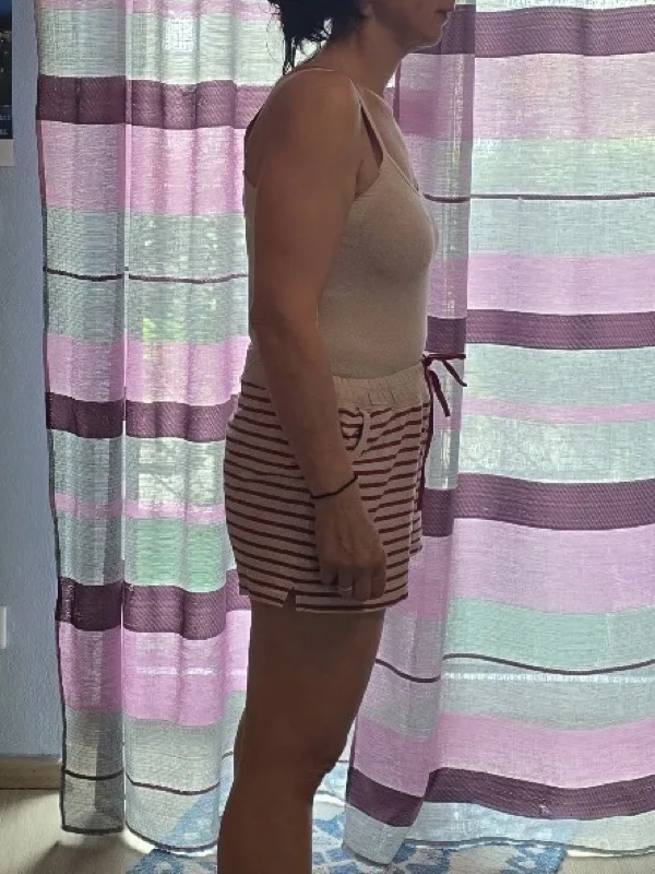 Katerina B. – Nachher