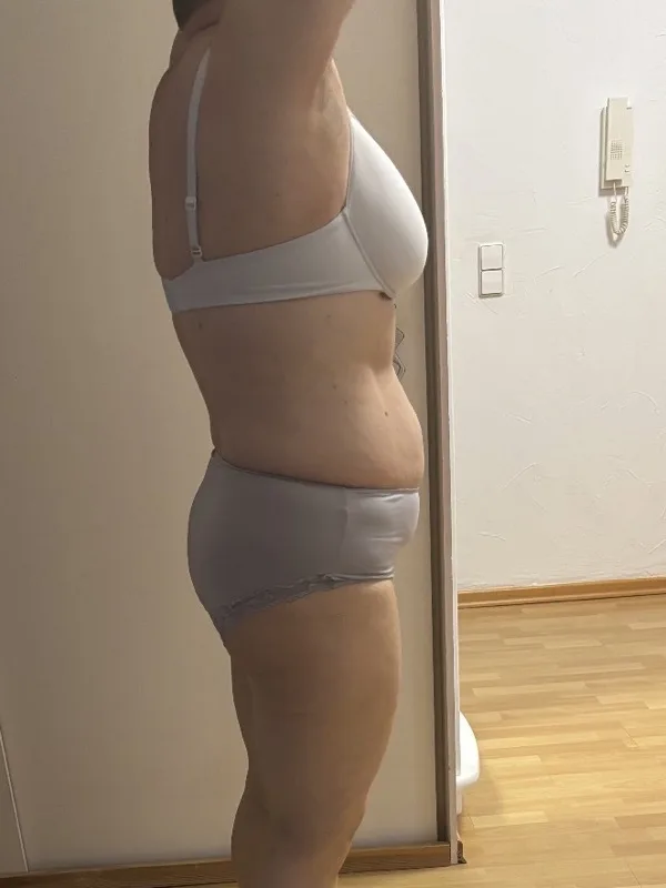 Melanie N. – Nachher