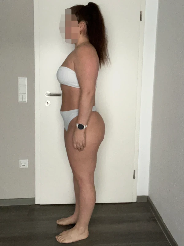 Swantje W. – Nachher