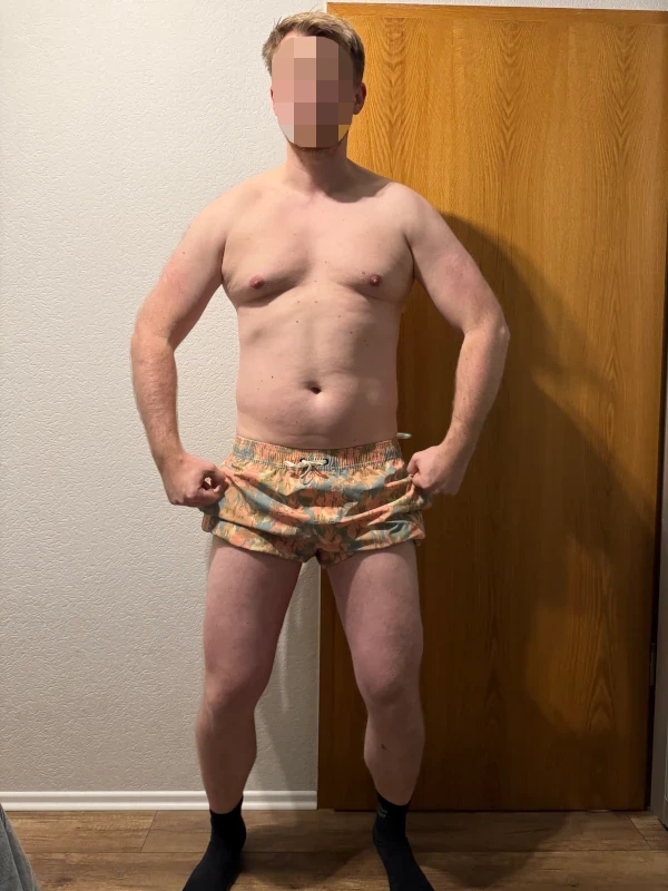 Marius W. – Vorher