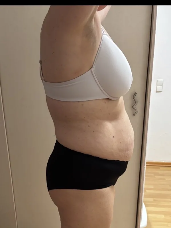Melanie N. – Vorher
